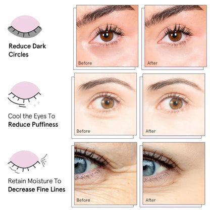 R&R Sadoer™ Collagen Hydrogel Eye Mask FREE SHIPPING ENDS AT 12PM